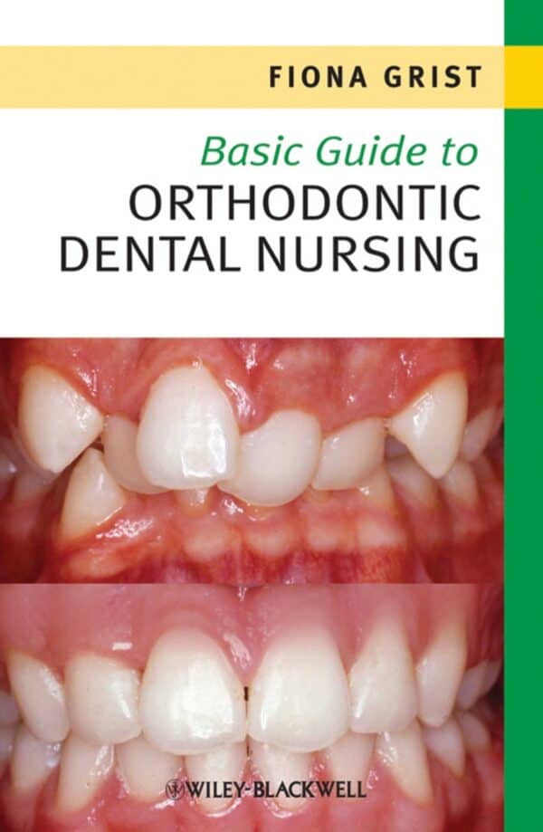 Basic Guide to Orthodontic Dental Nursing – eBook PDF