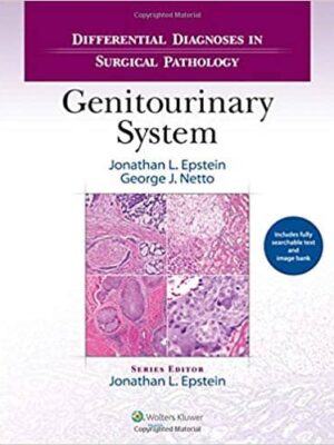 Differential Diagnoses in Surgical Pathology: Genitourinary System – eBook PDF