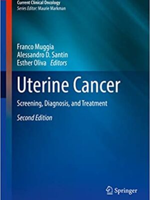 Uterine Cancer: Screening, Diagnosis, and Treatment (2nd Edition) – eBook PDF