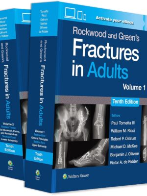Rockwood and Green's Fractures in Adults (10th Edition) eBook without Multimedia – eBook PDF